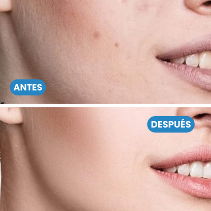 Sovana Sérum Nida - Unifica tu tono de piel y presume de un rostro sin manchas