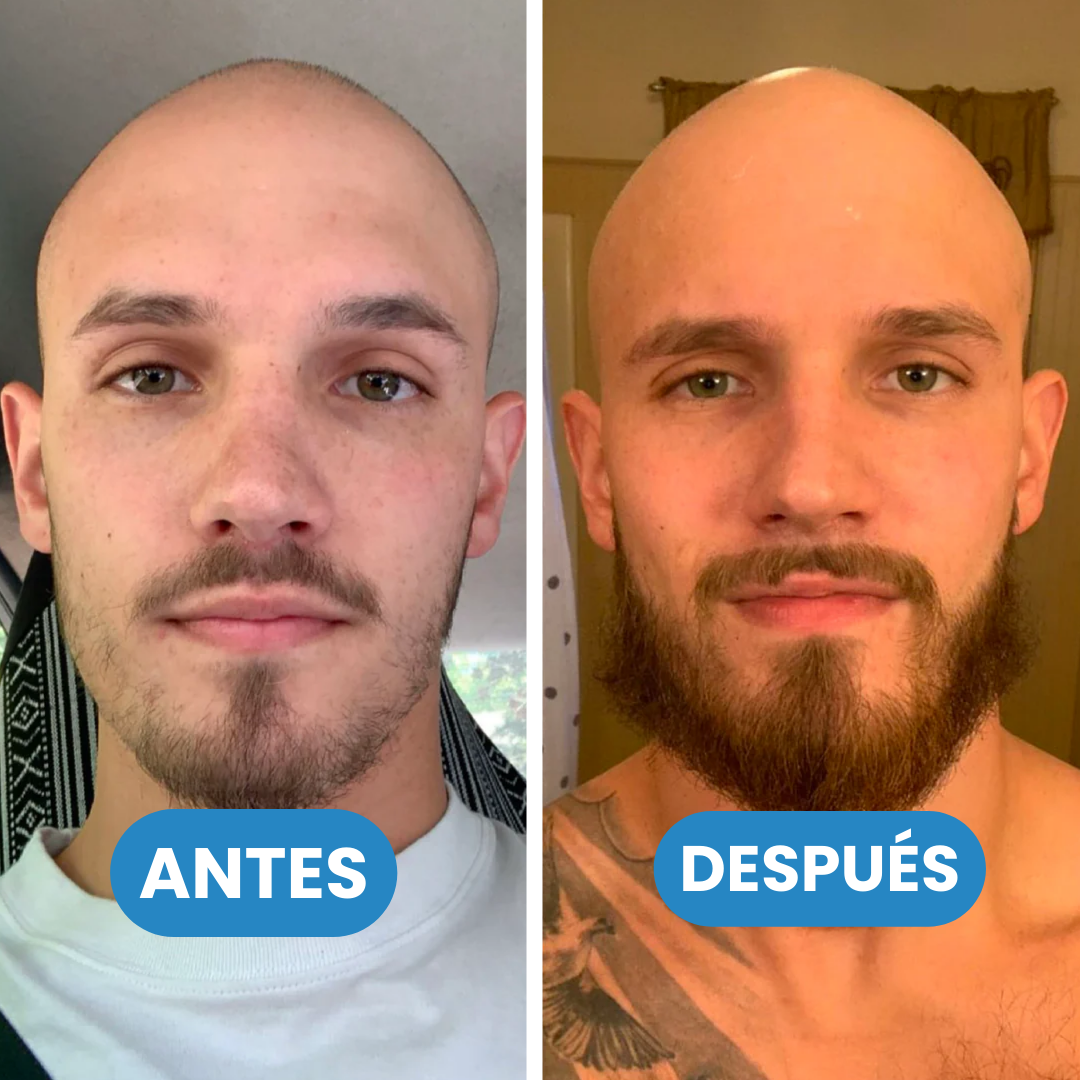 Sovana Jumbo Beard - Aceite estimulante para crecimiento de barba