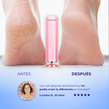 FootZen™ - Suaviza tus pies y elimina todos tus callos desde el primer día