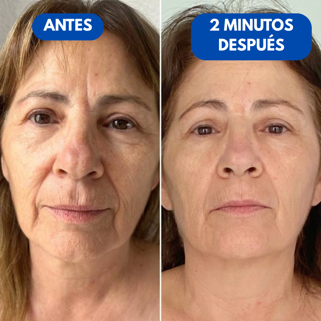 Sovana Peter Thomas™ - Crema tensora instantánea para bolsas y ojeras