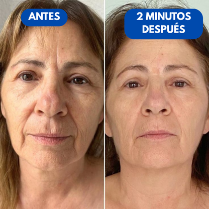Sovana Peter Thomas™ - Crema tensora instantánea para bolsas y ojeras