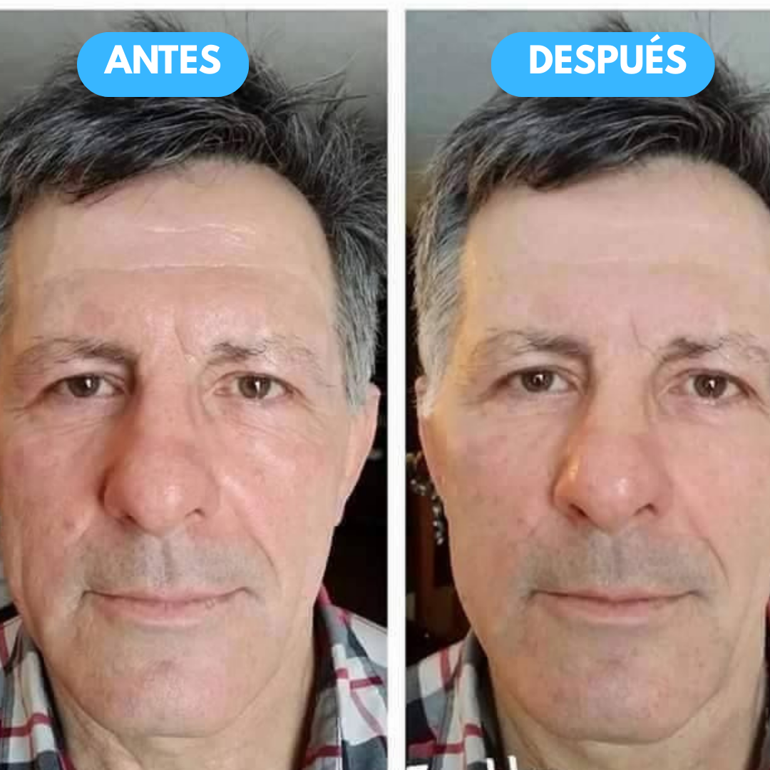 Sovana Peter Thomas™ - Crema tensora instantánea para ojeras y arrugas
