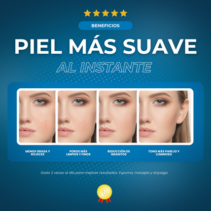 Sovana Revitalex - Jabón exfoliante con ácido salicílico anti-acné