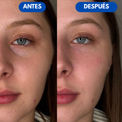 Sovana Tarte™ - El único corrector de ojeras con tecnología SkinSync™