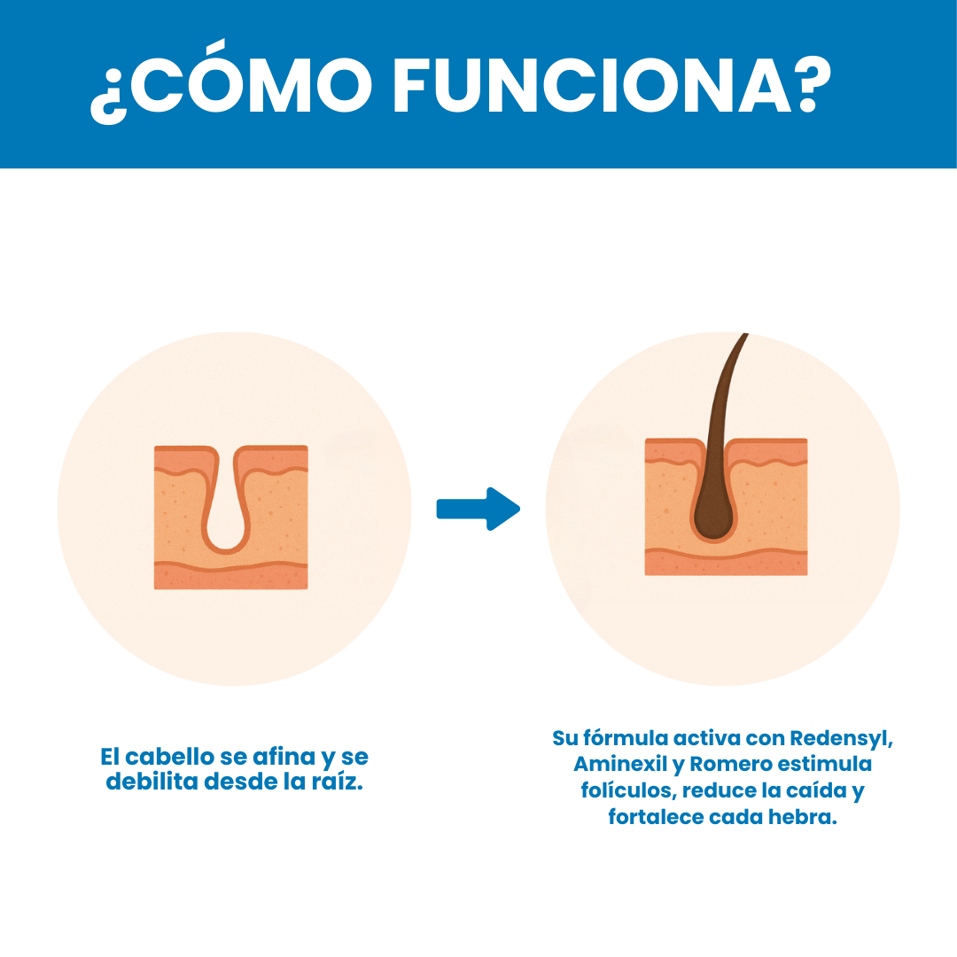 Sovana BodyWise - Sérum Roll-On para la defensa contra tus entradas