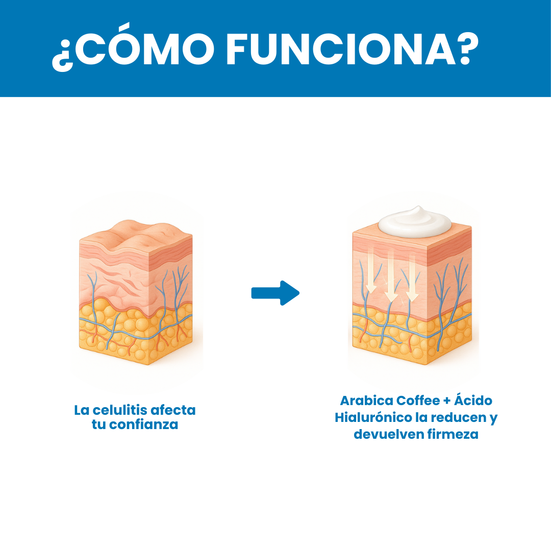 Sovana B Flat - Crema para el tratamiento de estrías