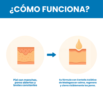 Sanorys Centella - Elimina manchas y puntos negros de tu rostro en sólo 6 días