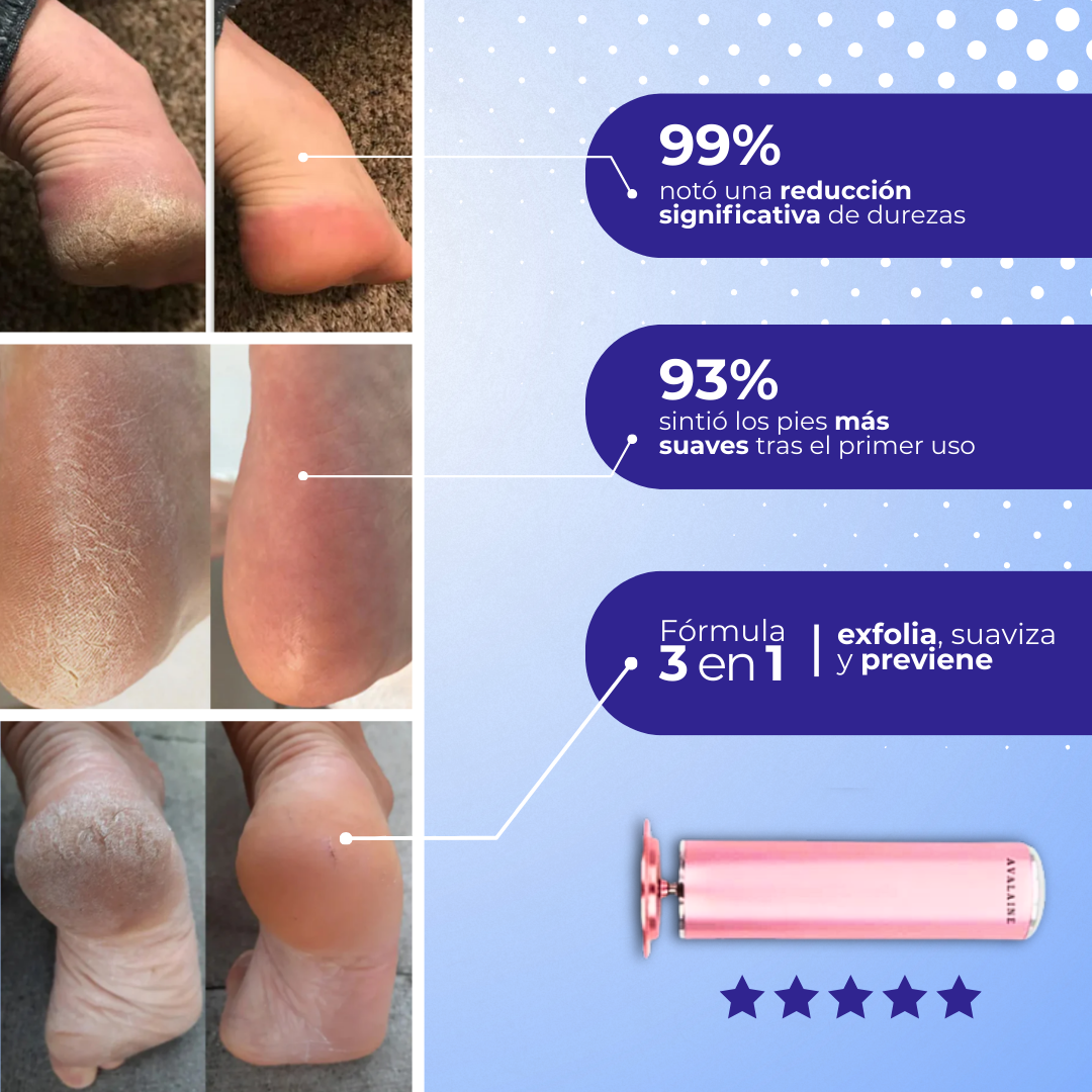 FootZen™ - Suaviza tus pies y elimina todos tus callos desde el primer día