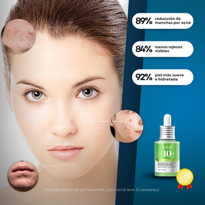 Sovana Anua - Sérum para eliminar tus manchas de acné en 6 días