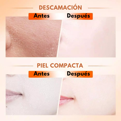 Sovana Sadoer™ - Tóner Anti-Edad para Borrar años de tu rostro en 7 Días