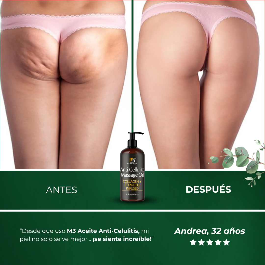 M3 - Aceite de colágeno para eliminar la celulitis por completo