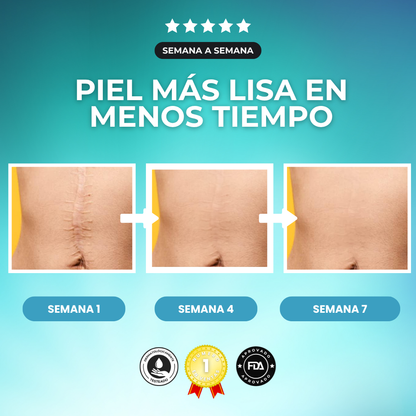 ScarTape - Tiras de silicona para hacer tus verrugas invisibles en segundos