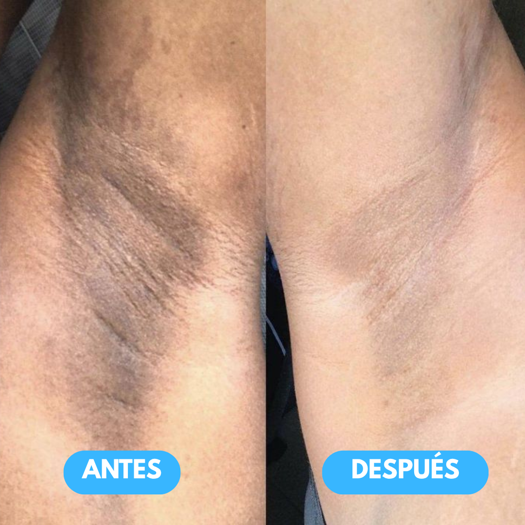 Jiyu - Parches coreanos eliminadores de manchas