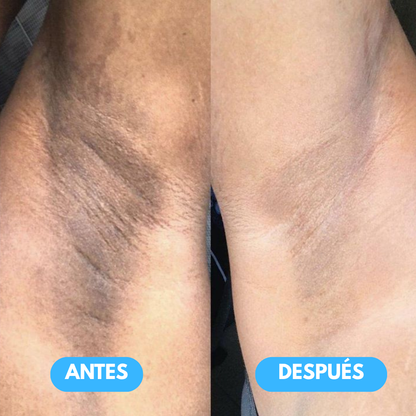 Jiyu - Parches coreanos eliminadores de manchas